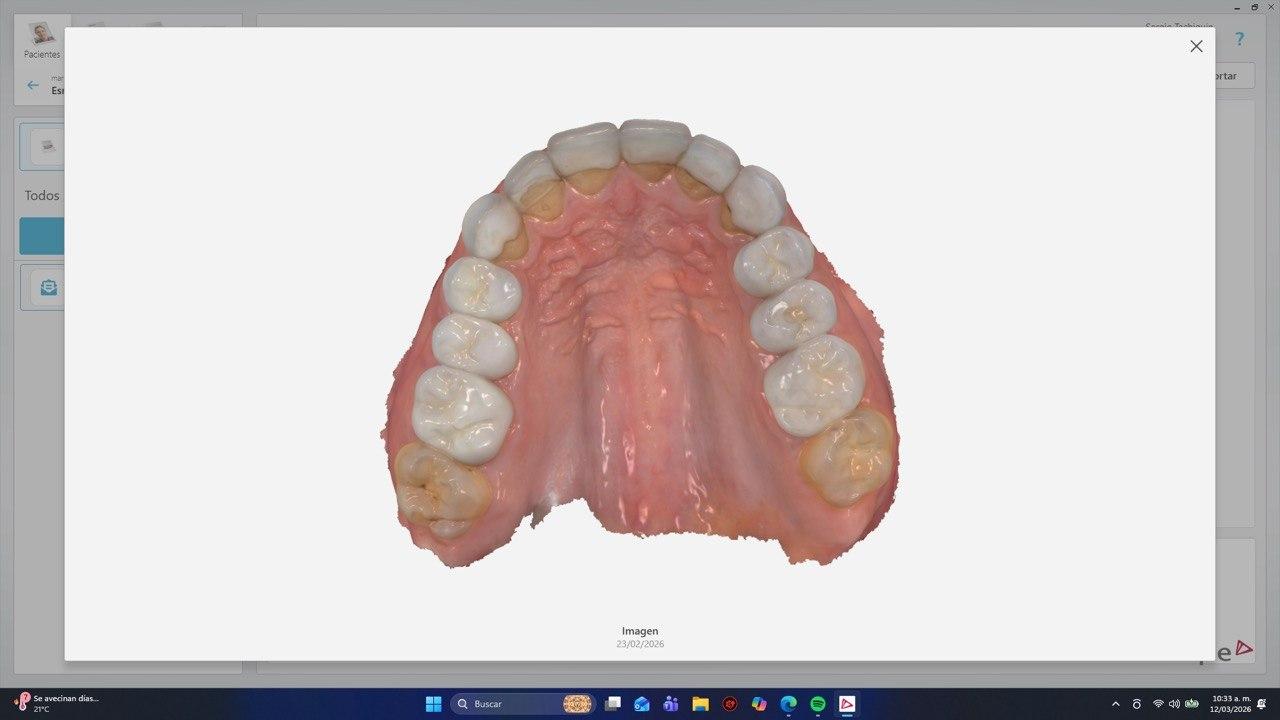 Diseño Digital de Sonrisa