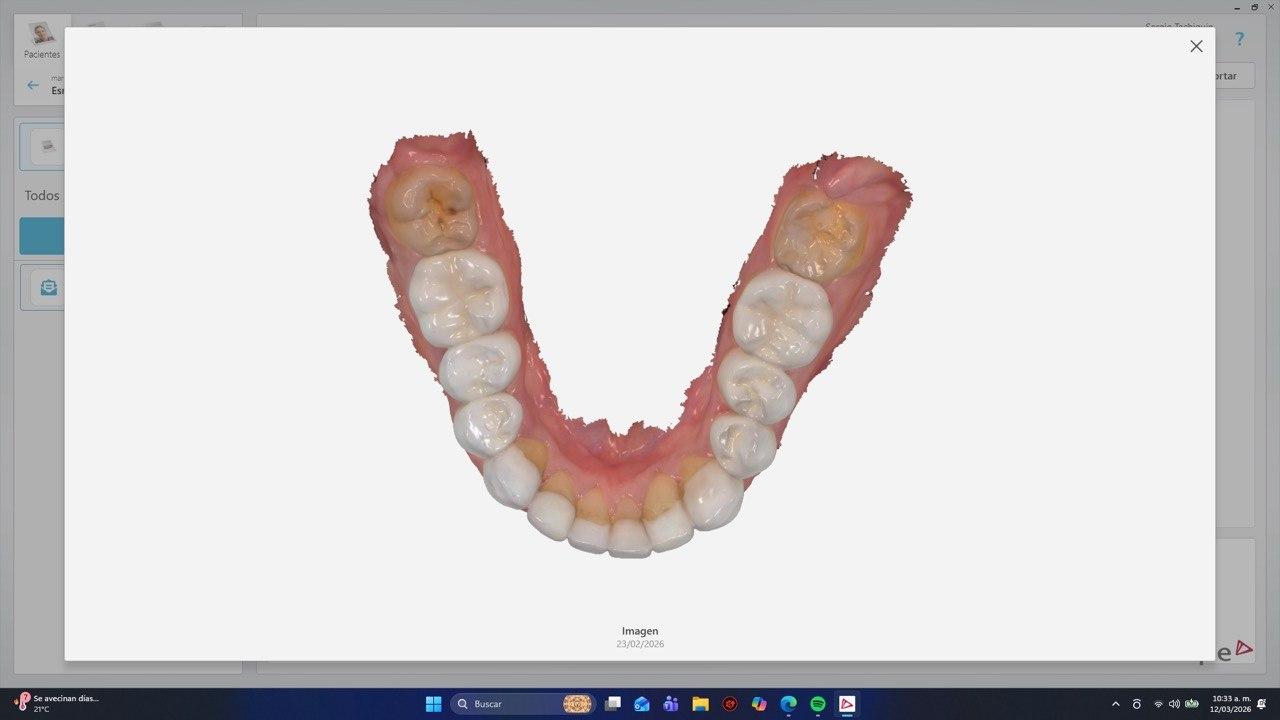 Tomografía Conebeam (CBCT)