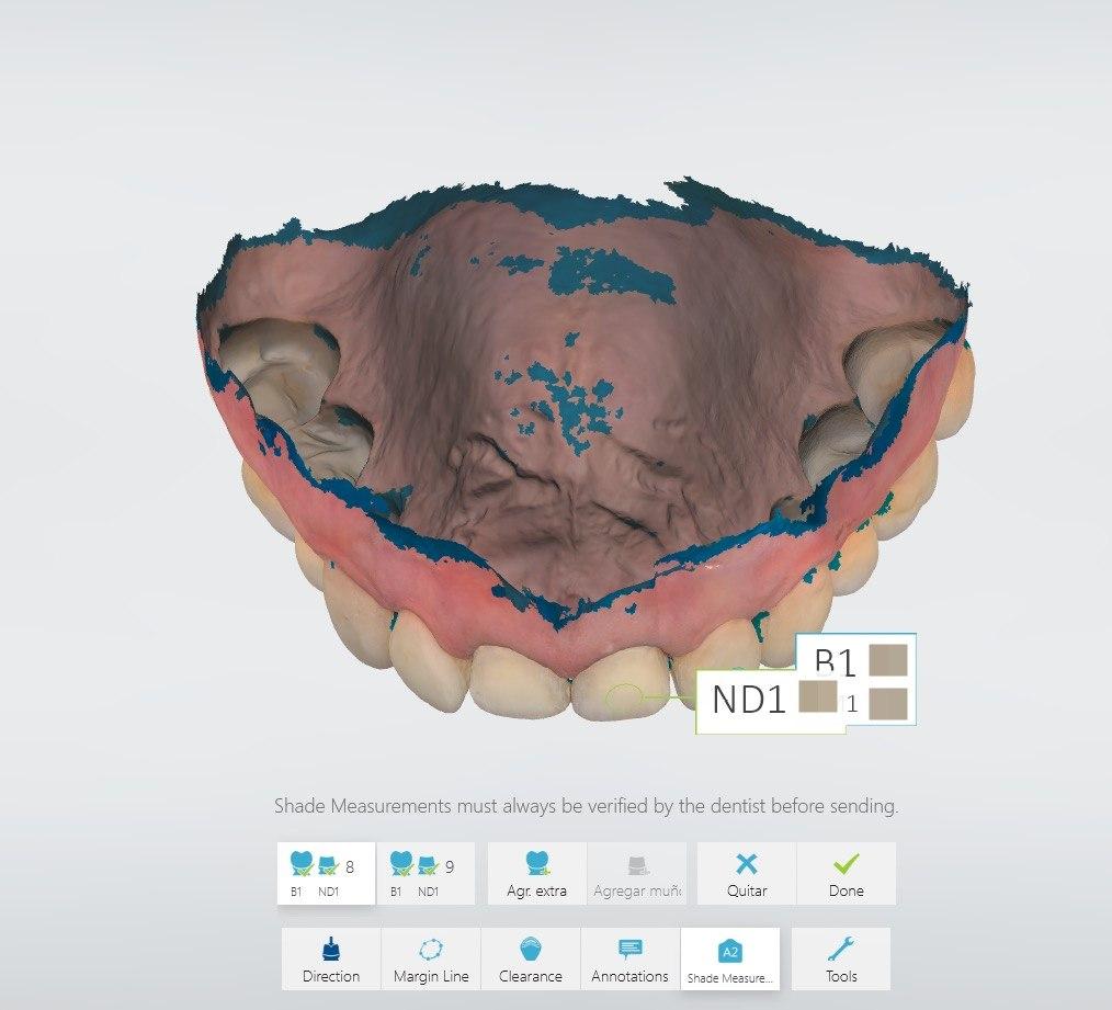 Escaneo intraoral 3D · 3Shape